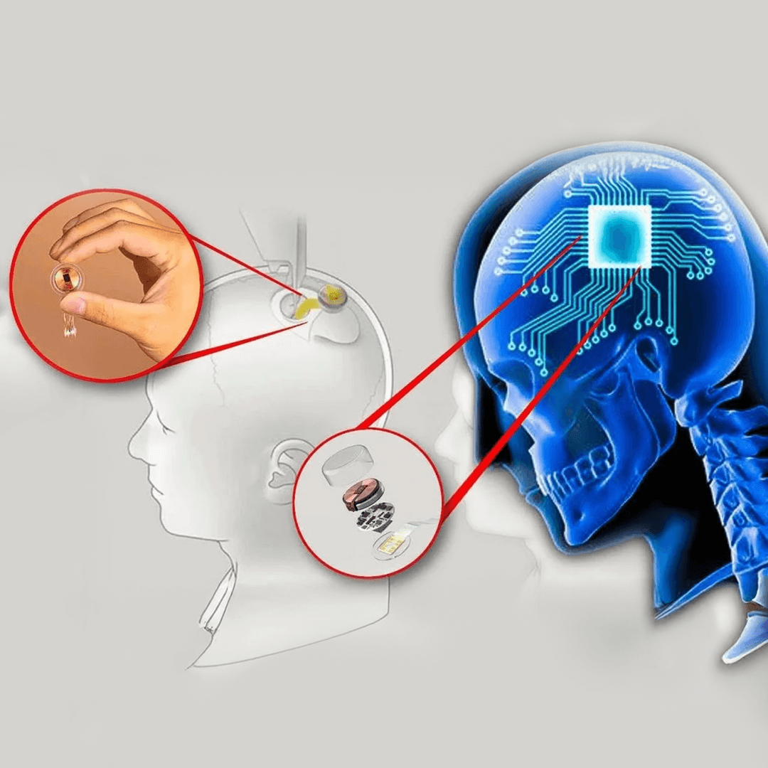 Brain and money concept